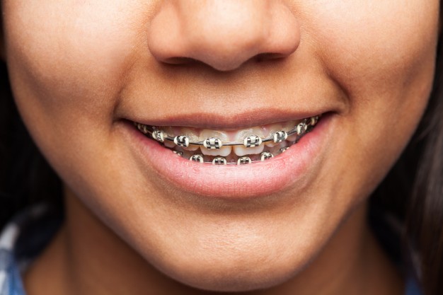 Dental Health and Orthodontic Problems